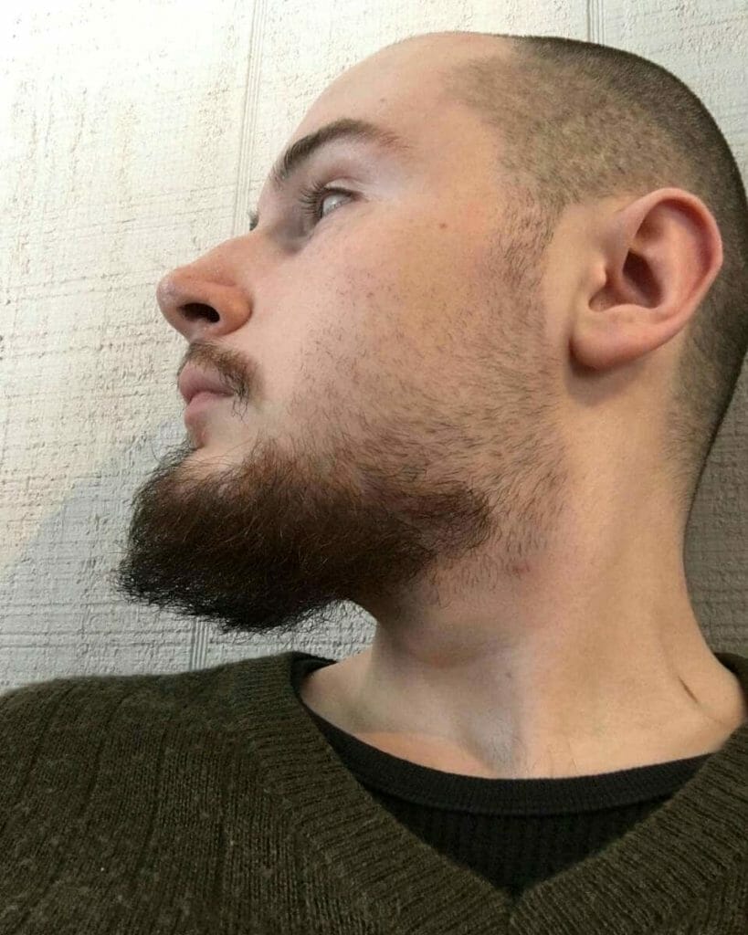 patchy beard