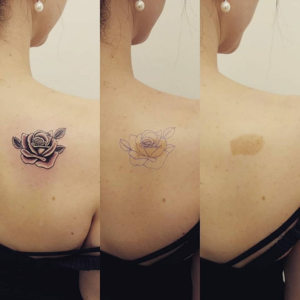 Birthmark Rose Cover Up Tattoo