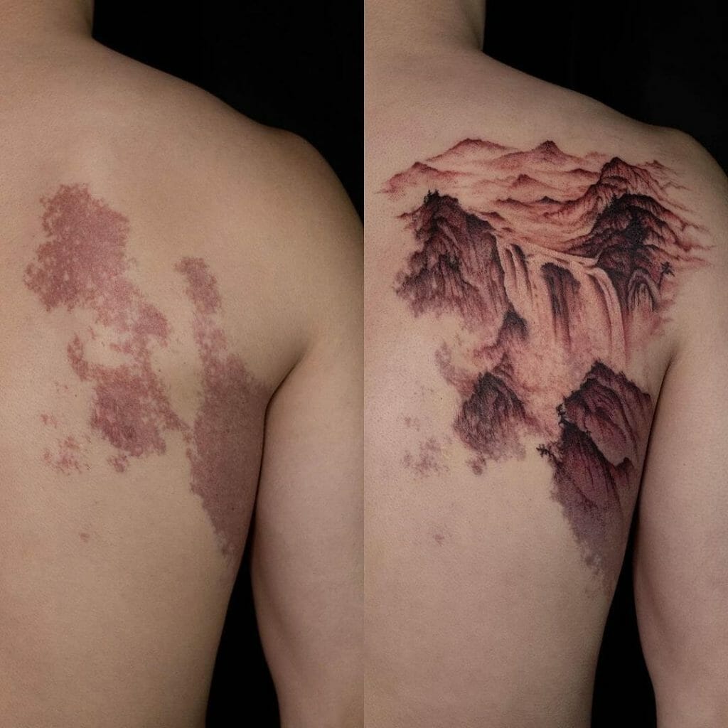 Birthmark Tattoo To Cover Up Discoloration