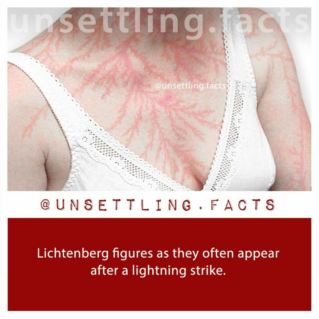 Lichtenberg Lightning Bolt Tattoo Designs