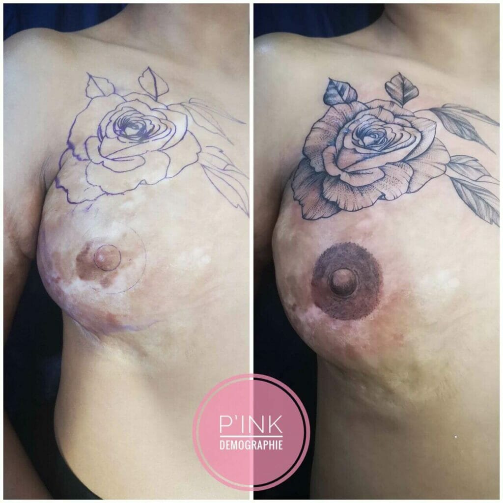 Breast Cancer Survivor Tattoo