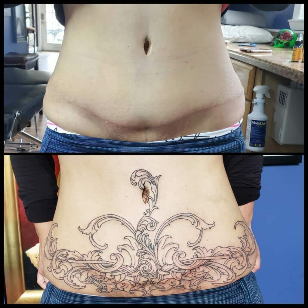 Abstract Art Cover Up C Section Scar Tattoo