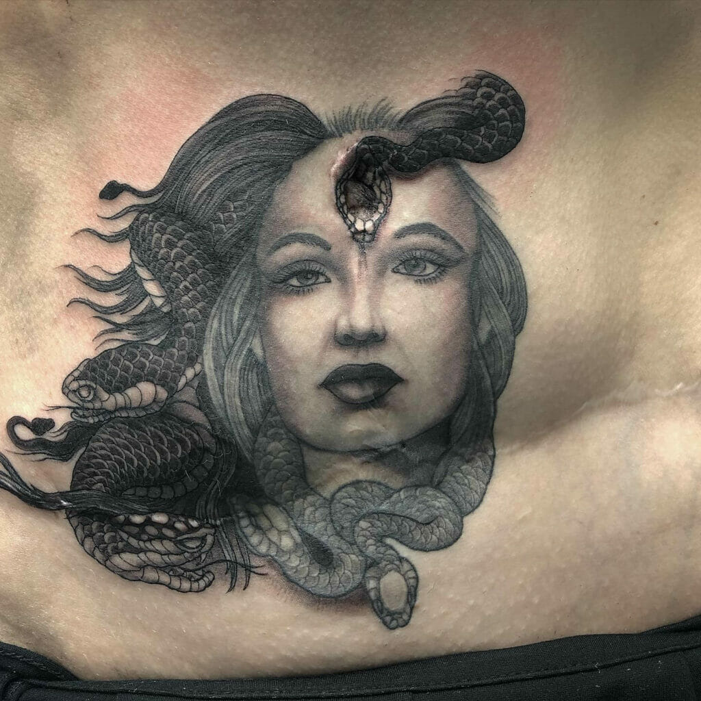 Medusa Tummy Tuck Tattoo