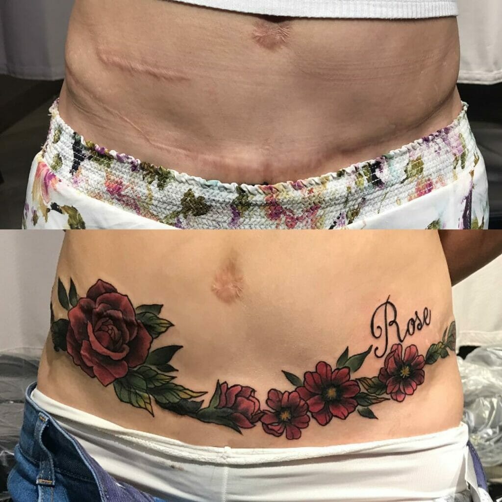 The Realistic Red Roses Waist-chain And The Scar Tattoo
