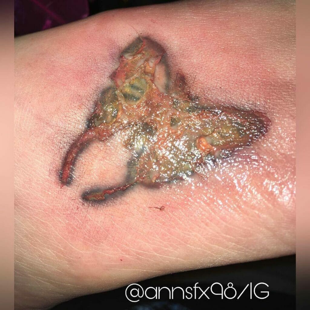 Infected Tattoo on the Foot