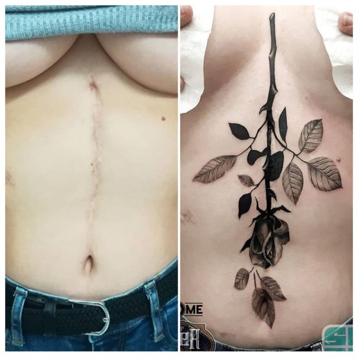 Tattoo To Cover Scars