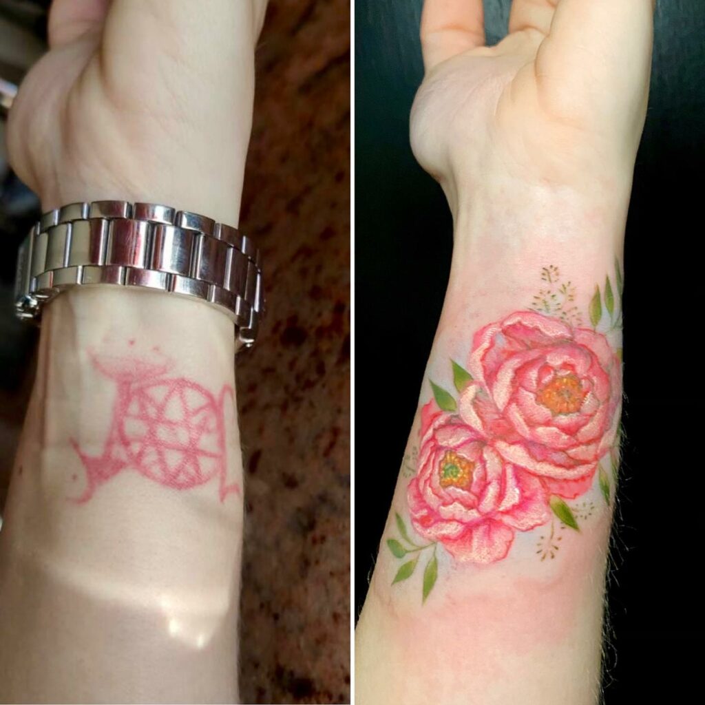 Tattoo To Cover Scars